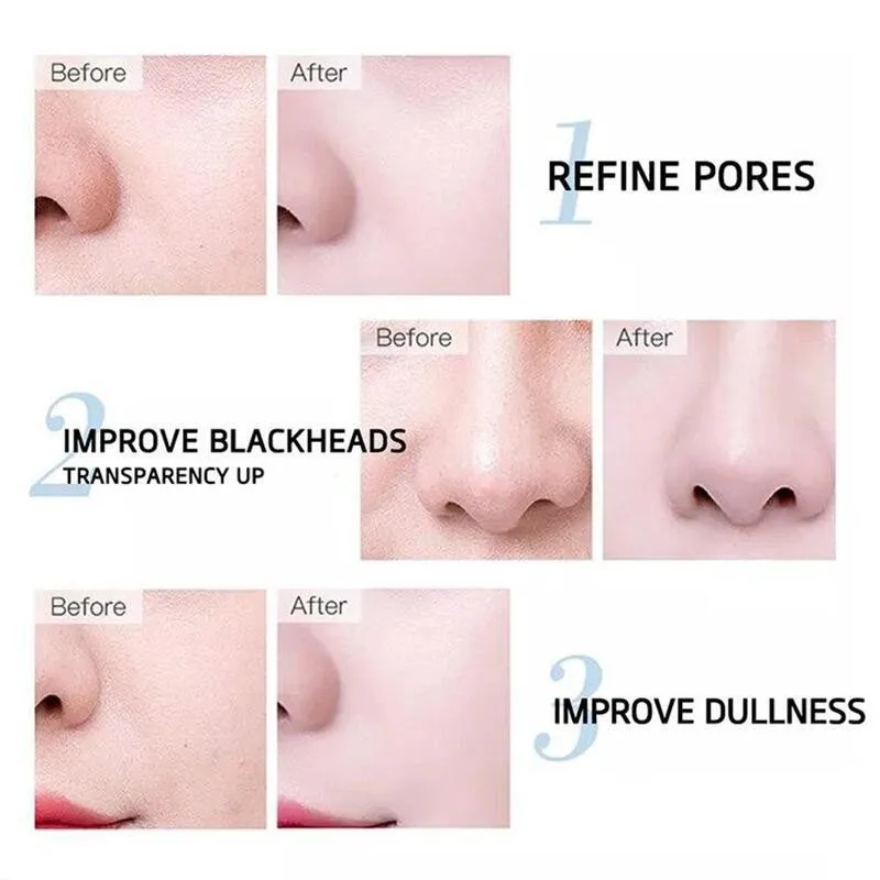 

Hyaluronic Acid Stock Solution Ampoule Hyaluronic Acid Essence Anti Moisturizing Lock Serum Aging Water Liquid Polym J3Z7