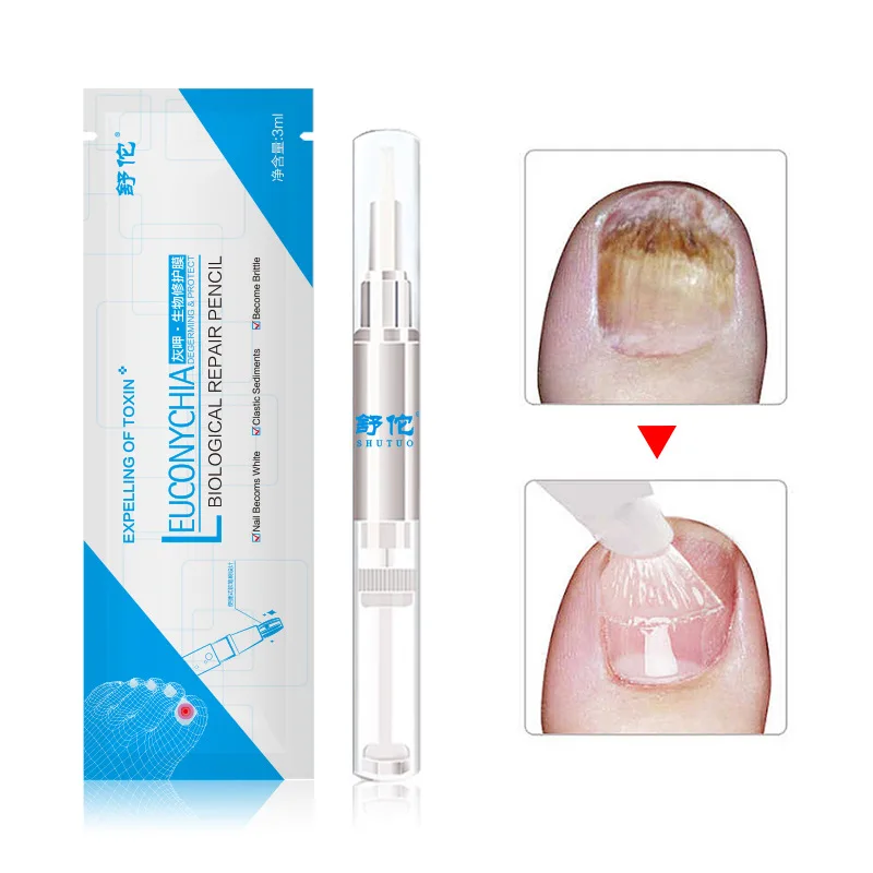 Яркий биологический ремонт мембранный Уход за ногтями решение для кольчатого