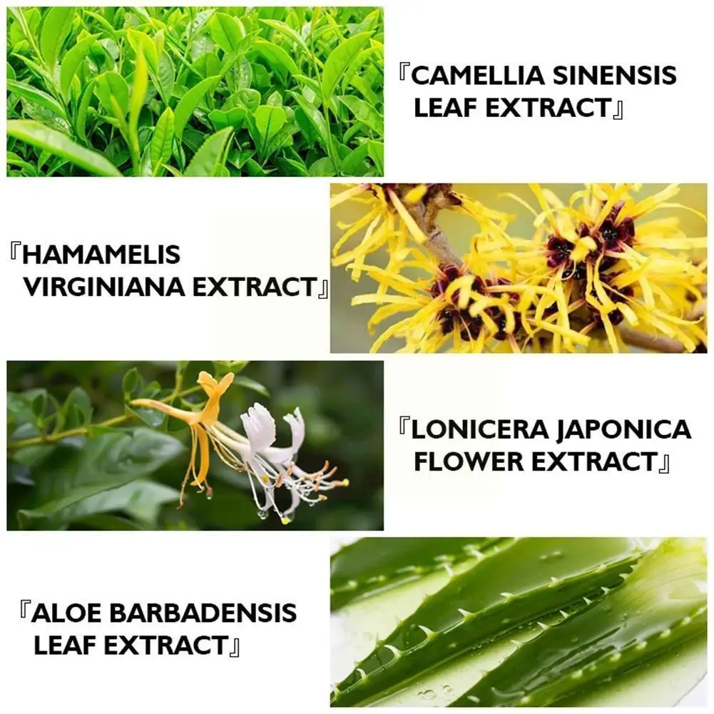 

30ml Natural Herbal Acne Treatment Cream Oil Control Pores Brighten Scars Care Nourish Marks Cream Skin Shrink Whitening Re P3C7