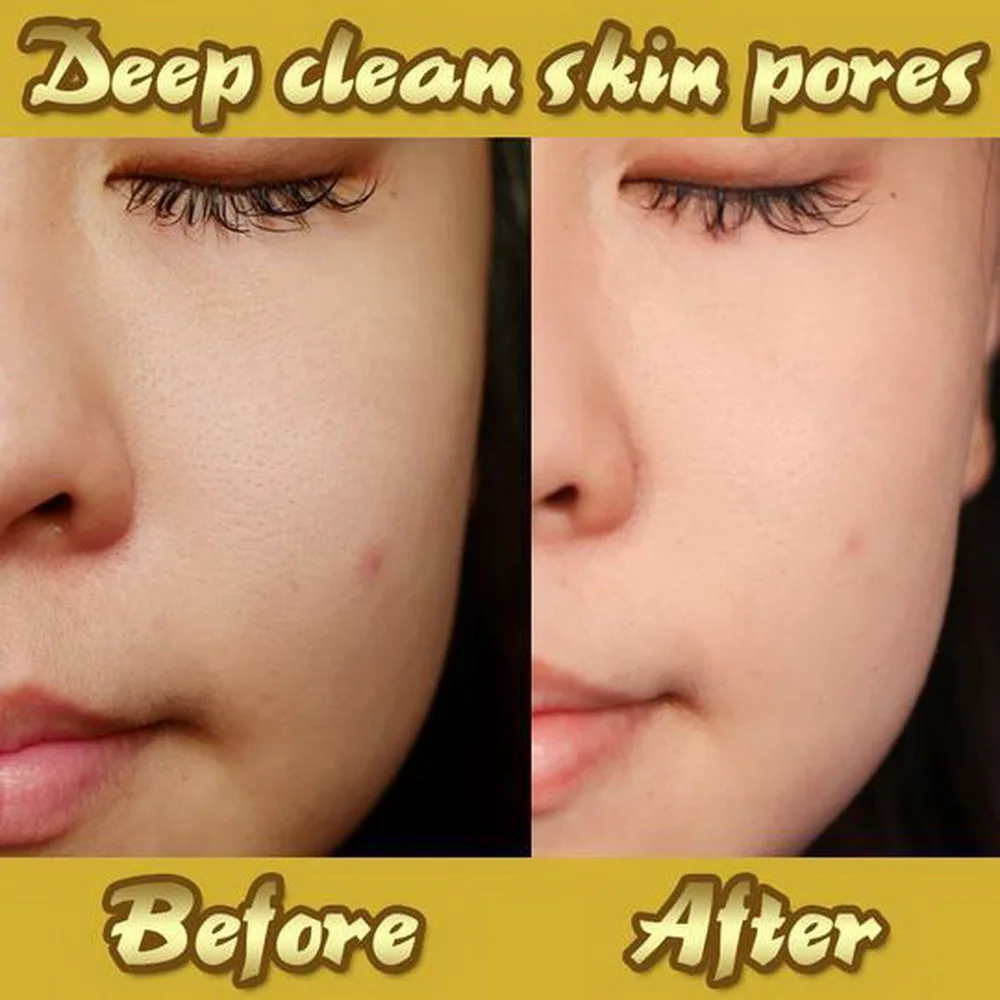 Отшелушивающая маска для лица отбеливающие маски против морщин Уход за кожей