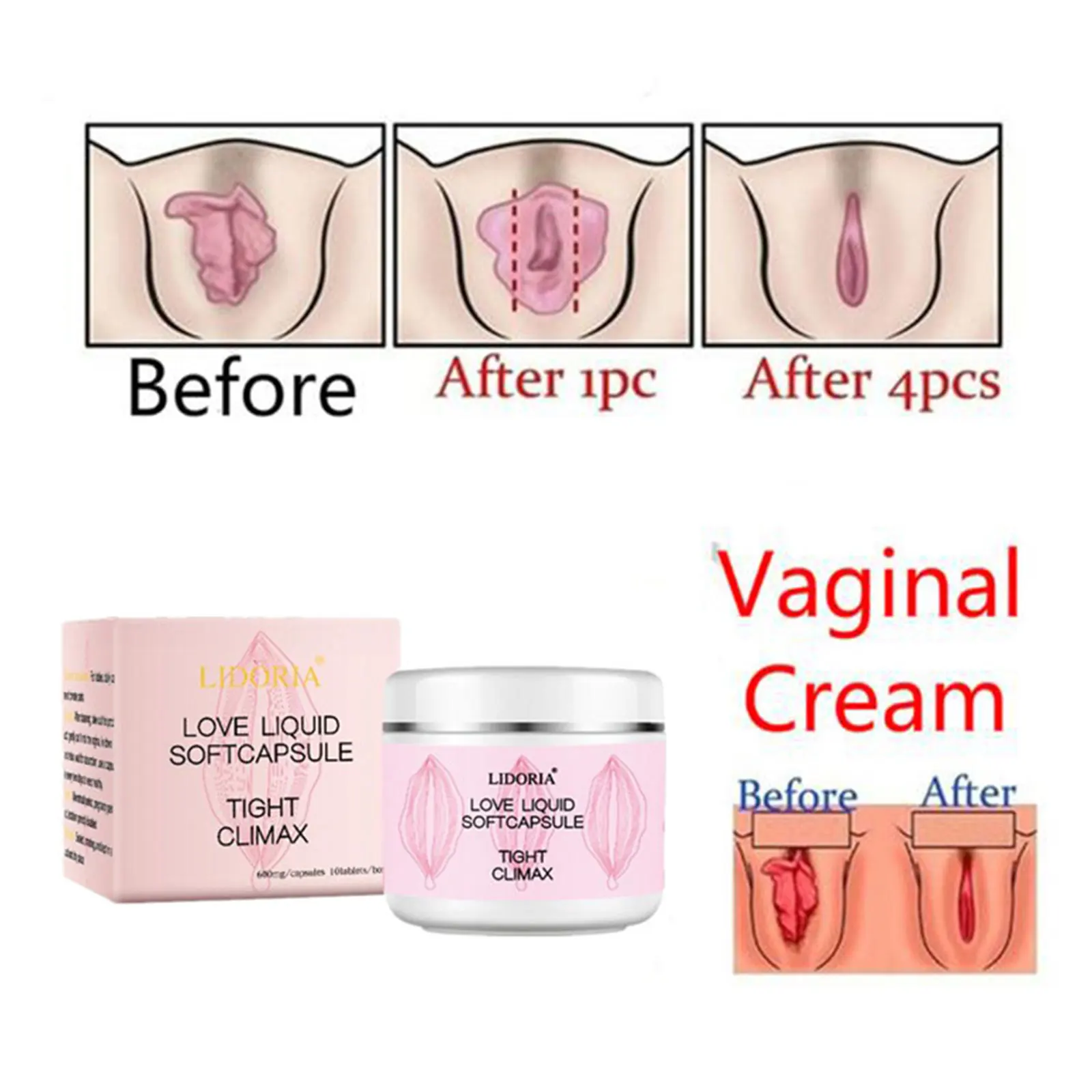 Vaginalcaregel