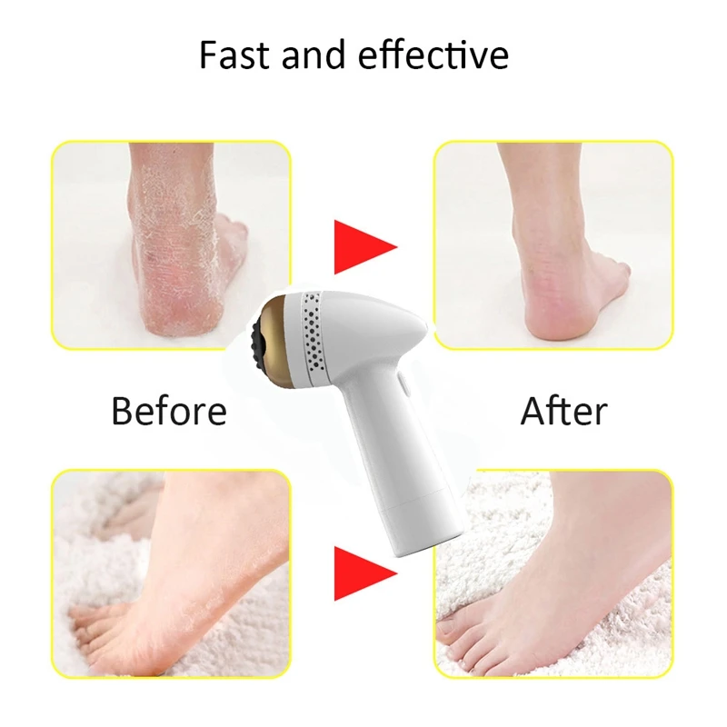 Электрический педикюр пилка для ног Педикюр мозоли удаление USB зарядка