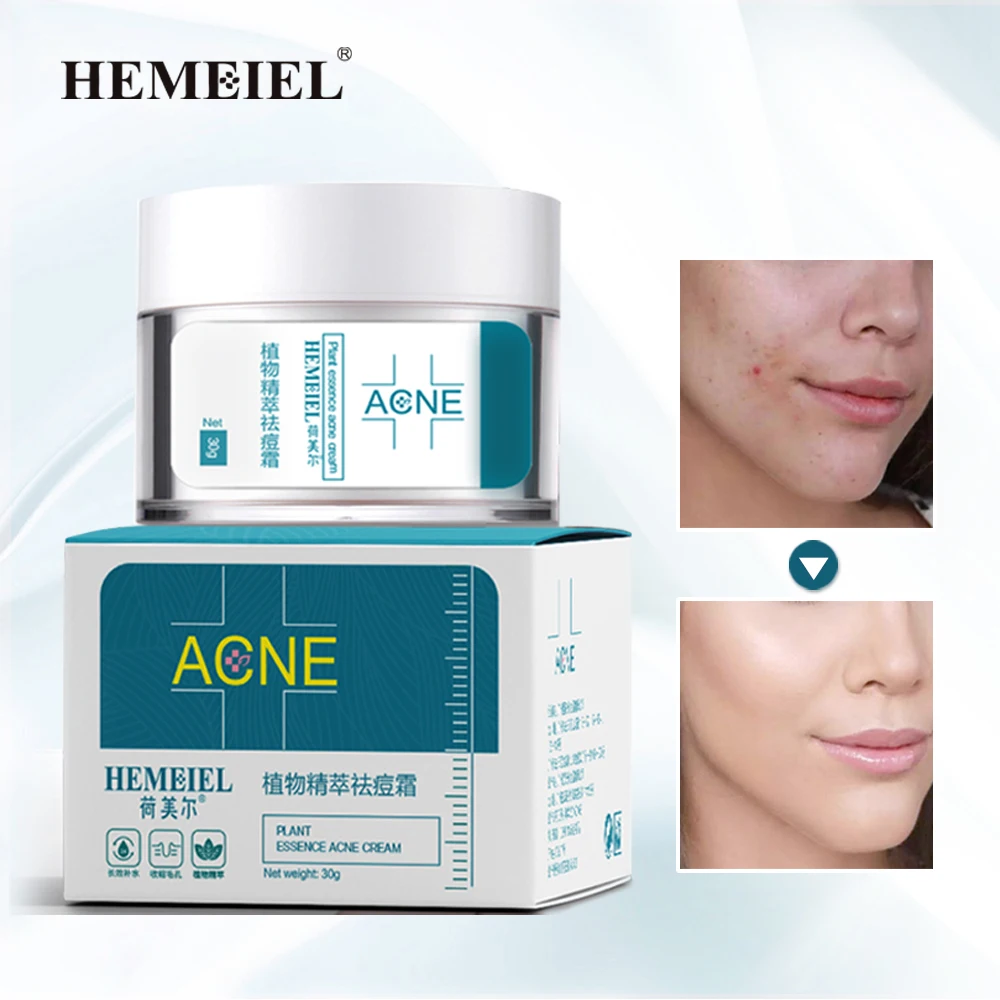 

Набор для ухода за кожей лица Hemeiel, крем против прыщей и кожи лица