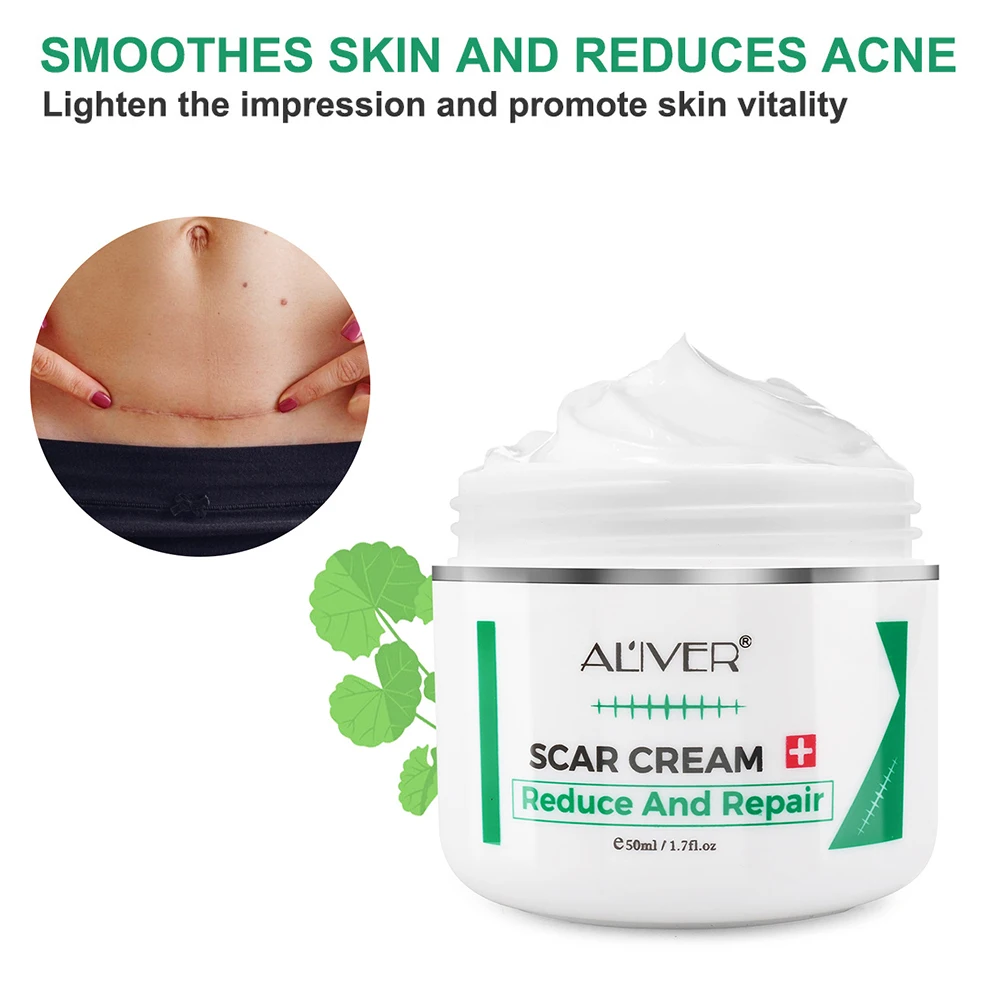 

Face Acne Mark Removal Cream Body Skin Burn Surgical Scars Repair Treatment for Facial Skin Care Cream