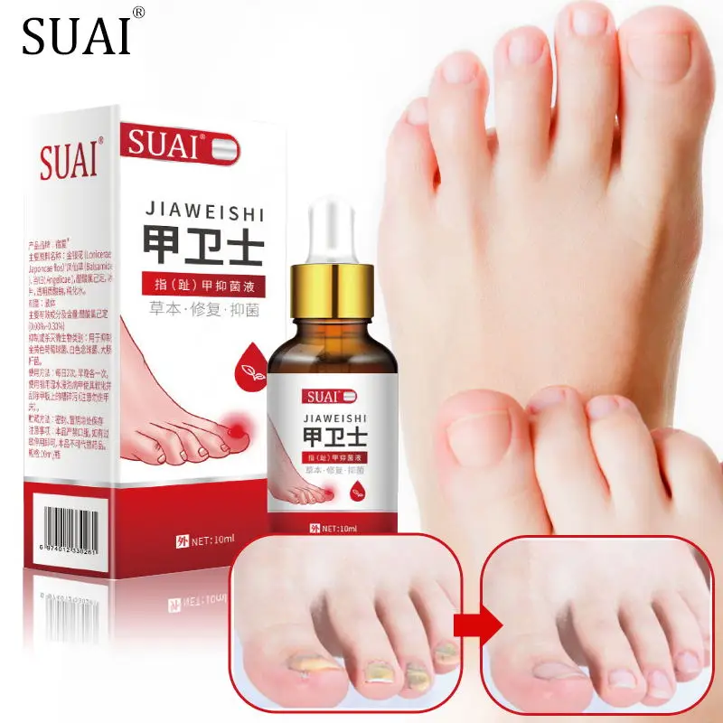

Nail Fungal Removal Essence Fungal Nail Treatment Serum Anti Infection Cure Paronychia Onychomycosis Toe Fungus Repair Feet Care