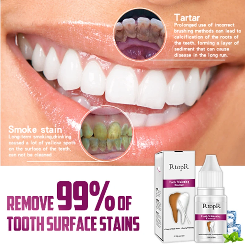 Отбеливающая эссенция для гигиены полости рта ежедневного использования