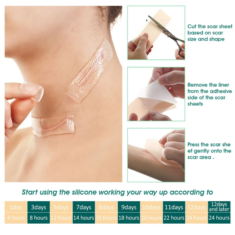 

4Pcs/Box Silicone Gel Strips Patch Scar Removal Remove Trauma Burn Scar Sheet Skin Repair Therapy Patches 27RC