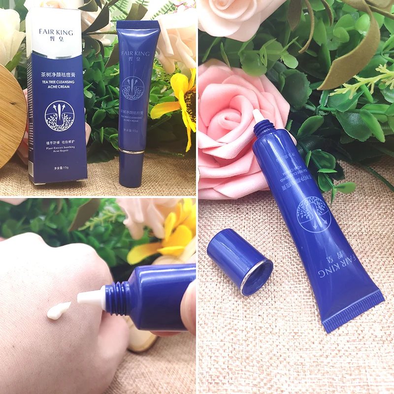 

15ML Acne Treatment Blackhead Remova Anti Acne Cream Oil Control Shrink Pores Acne Scar Remove Face Care Whitening
