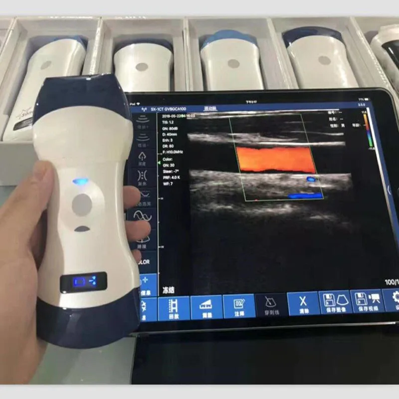 128 elements PW color wireless veterinary ultrasound convex and linear probe double head animal pregnancy main product image