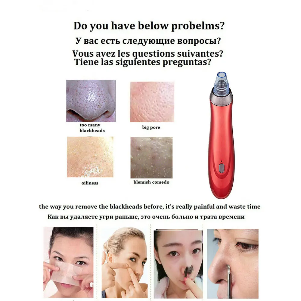 Blackhead Beauty Apparatus Black Head Cleaner Removal Equipment Fast Fashion Effective 3 Colors ABS Acne Massage | Красота и здоровье