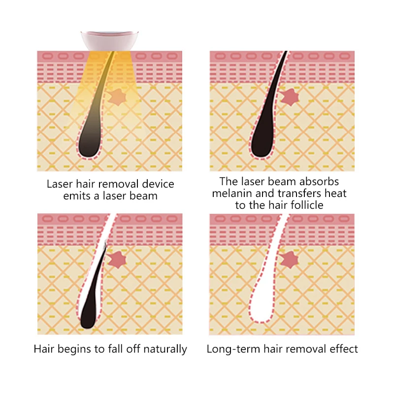 IPL импульсный прибор для удаления волос Прямая продажа от производителя домашняя