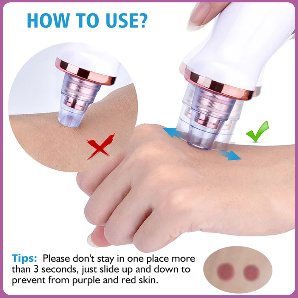 Пылесос вакуумный Перезаряжаемый для удаления черных точек акне прыщей Т-зоны