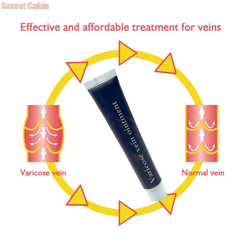 

Varicose Veins Treatment Cream Ointment Vasculitis Phlebitis Spider Veins Pain