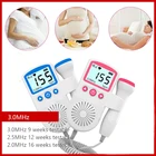 Допплер плода с ЖК-дисплеем, 2,5 МГц