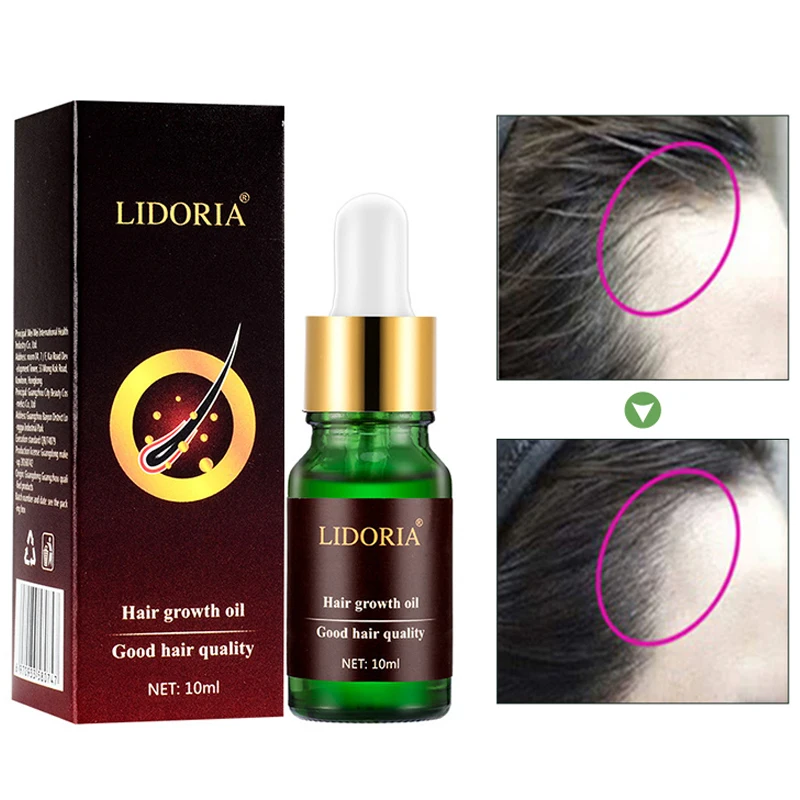 Сыворотка для роста волос 10 мл женщин и мужчин против выпадения Alopecia жидкость