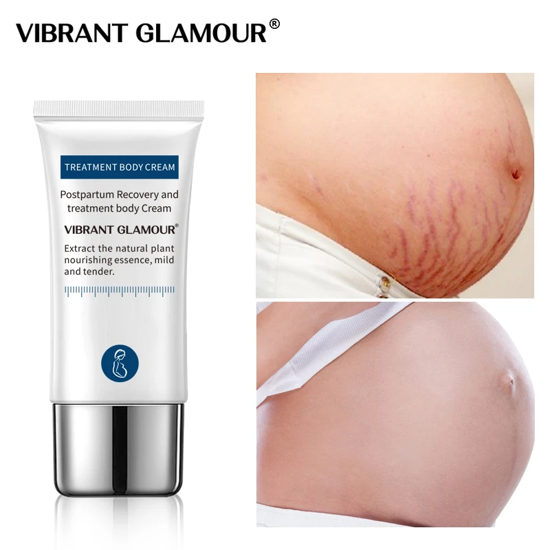 Crocodile Stretch Marks Remover Cream Anti Aging Winkles Firming Body Care Pregnancy Scars Ance Maternity Repair Dropshipping |