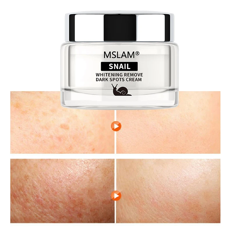

MSLAM Snail Remove Freckle Face Cream Whitening Fades Spot Cosmetics Moisturizing Firming Anti-Aging Brighten Facial Skin Care