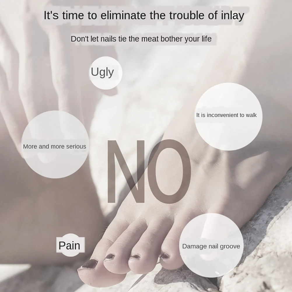 

Toe Nail Pedicure Tool Toenails Correction Pedicure Foot File Elastic Patch Straightening Clip Brace Corrector Wire Fixer