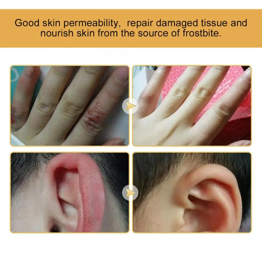 2 шт. детский уход за кожей рук ремонт мазь Лечение трещин питательный крем телом