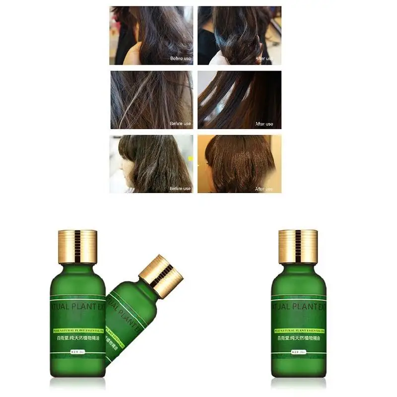 

Hair Growth Essence Oil Supplement Fuller Thicker Regrowth Treatment for Hair Loss Care 30ml ZGOOD