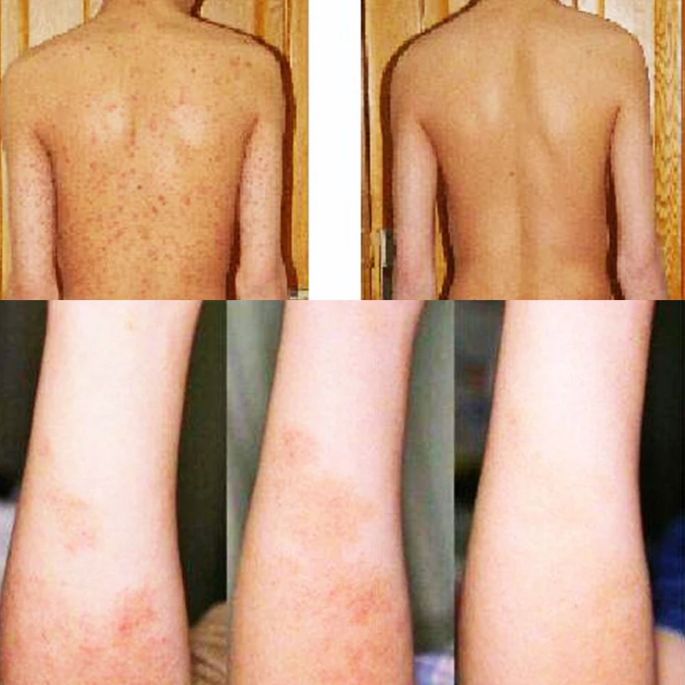 Китайская травяная кожа актуальная антипретическая мазь крем анальгетический