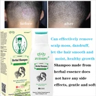 120 мл Zudaifu мох для чистки кожи головы от грибковой перхоти и шерсти головы, удаление больших кусочков перхоти