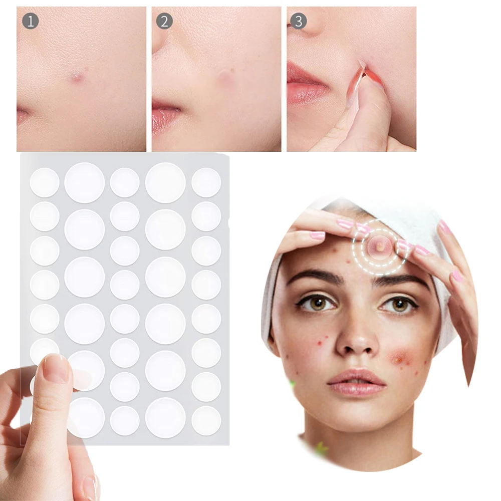 

36Pcs /Set Acne Pimple Patch Invisible Stickers Acne Treatment Pimple Remover Tool Waterproof Easy Makeup Skin Care Tool Mask