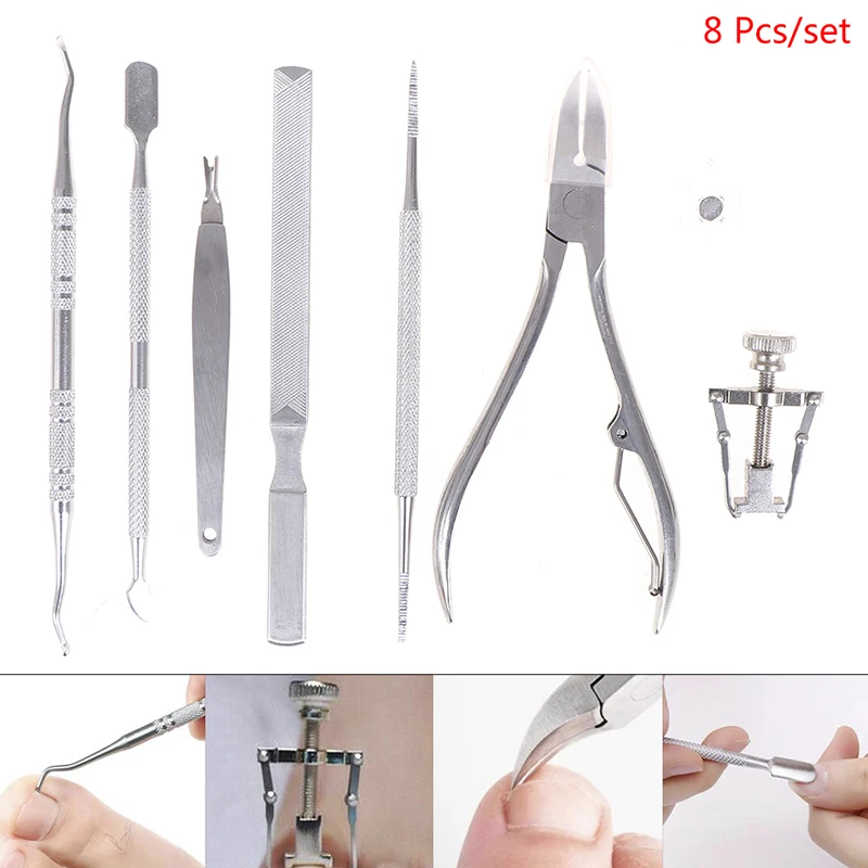 

8X Ingrown Toenail Correction Treatment Pedicure Set Tools Kit Removal Foot Care