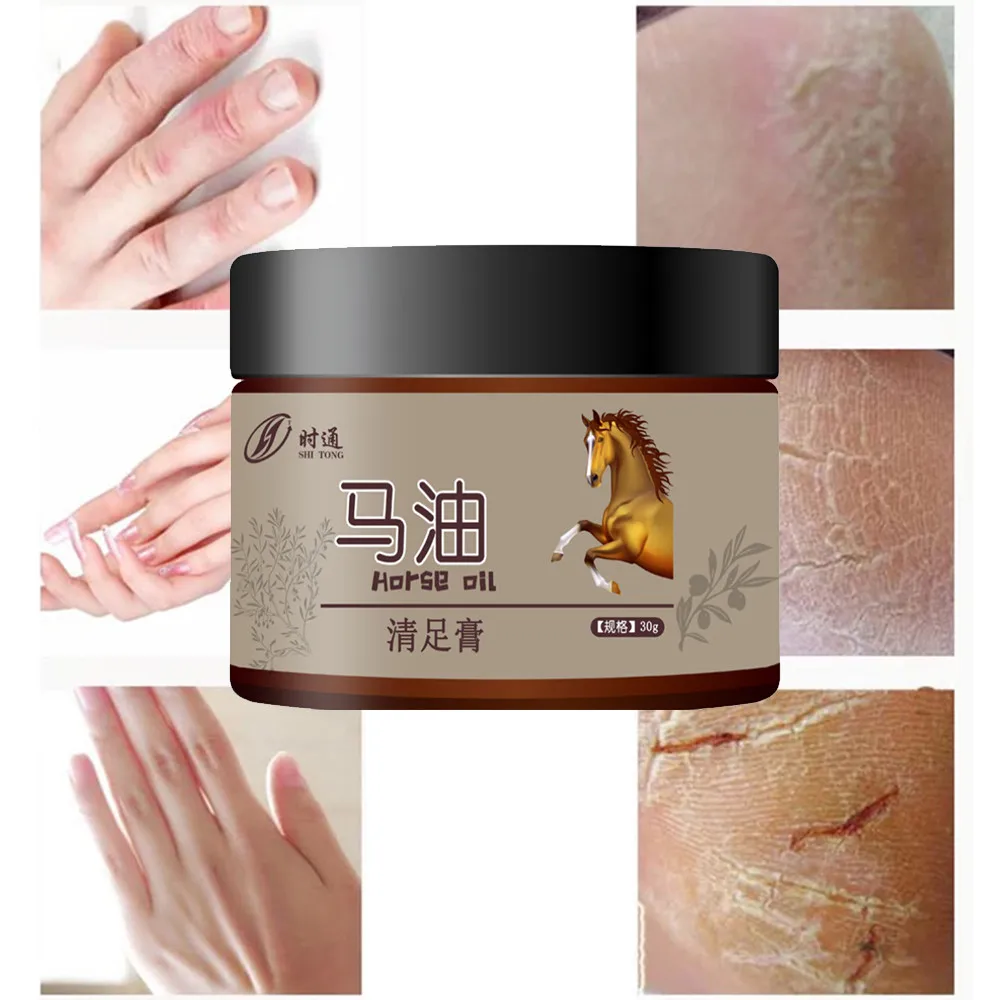 Highly Concentrated Moisturizing Agent Cracking Cream For Rough Dry And Cracked Heel Skin Anti-heel | Красота и здоровье