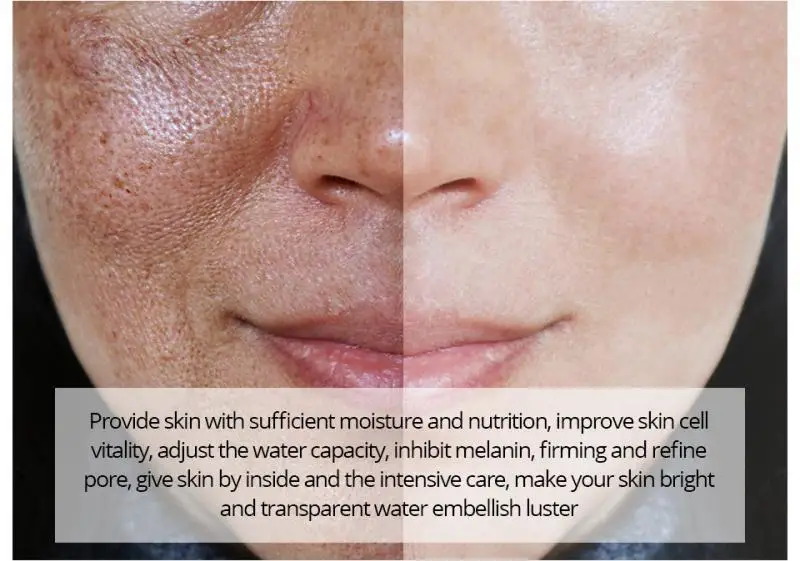 

Salicylic acid Face Serum Hyaluronic Acid Shrink Pores Essence Liquid Moisturizing Oil Control Anti-Wrinkle Lighten Skin Care