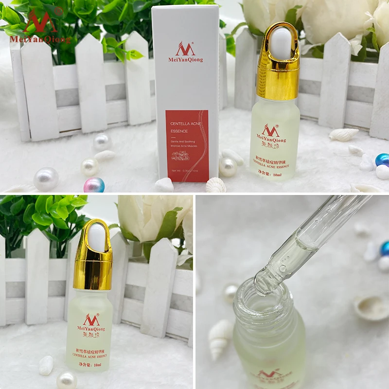 Лечение акне Сыворотка для лица центелла азиатская контроль жирности сужает