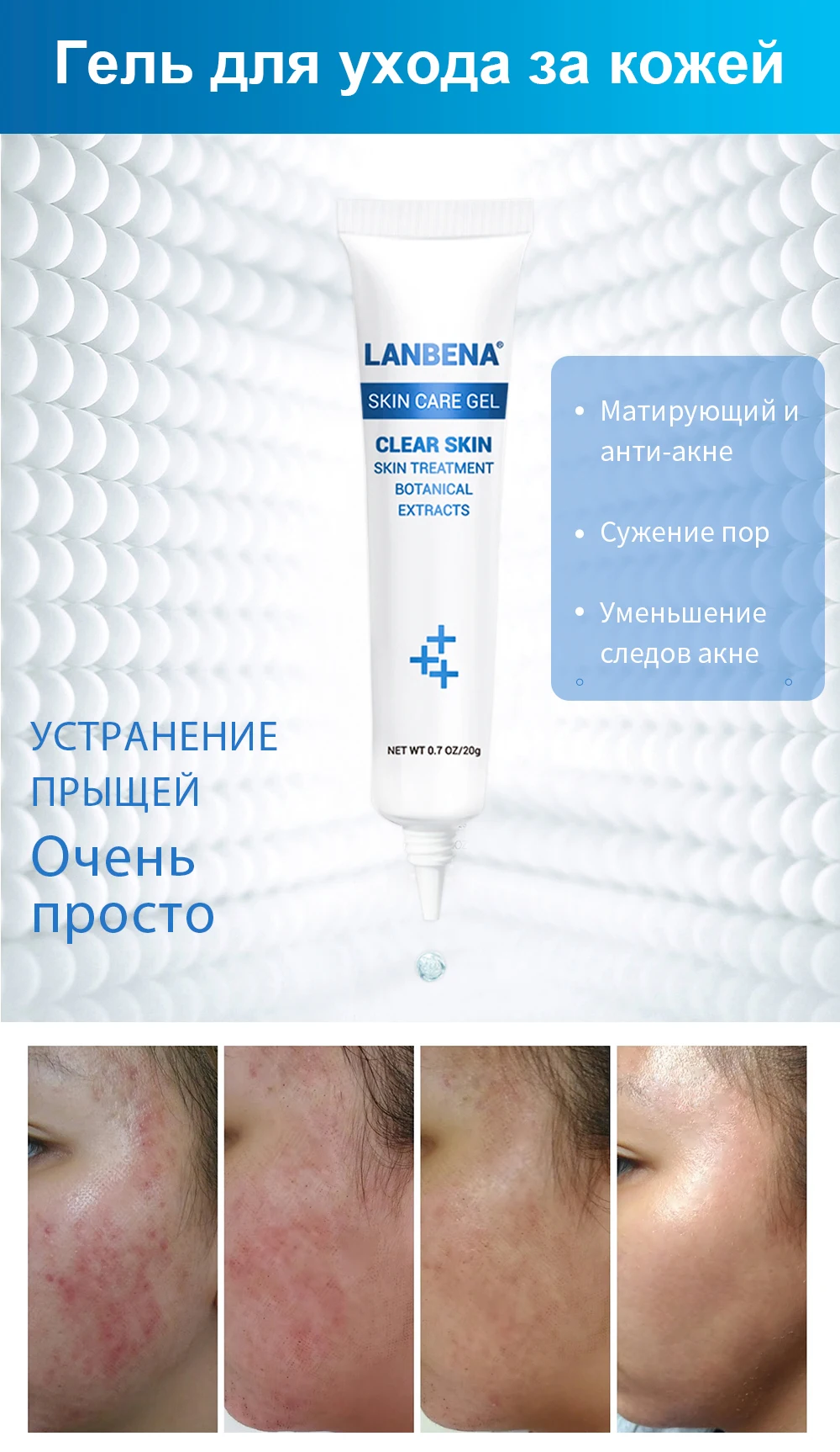 LANBENA маска для лица, лечение акне, маска для лица, уход за кожей, средство для удаления прыщей, патчи, наклейки, черная маска, пилинг, маски для лица
