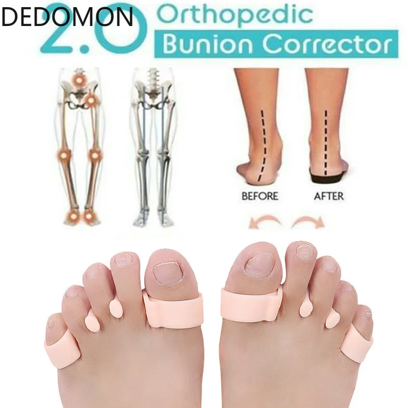 1 пара разделители большого пальца ноги 2 цвета|Инструмент для ухода за ступнями| |