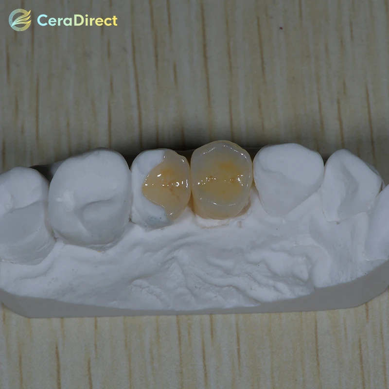 [10 дней-доставка] керамические блоки из лития ceradirect (стеклянная керамика)-C14-HT/LT(5