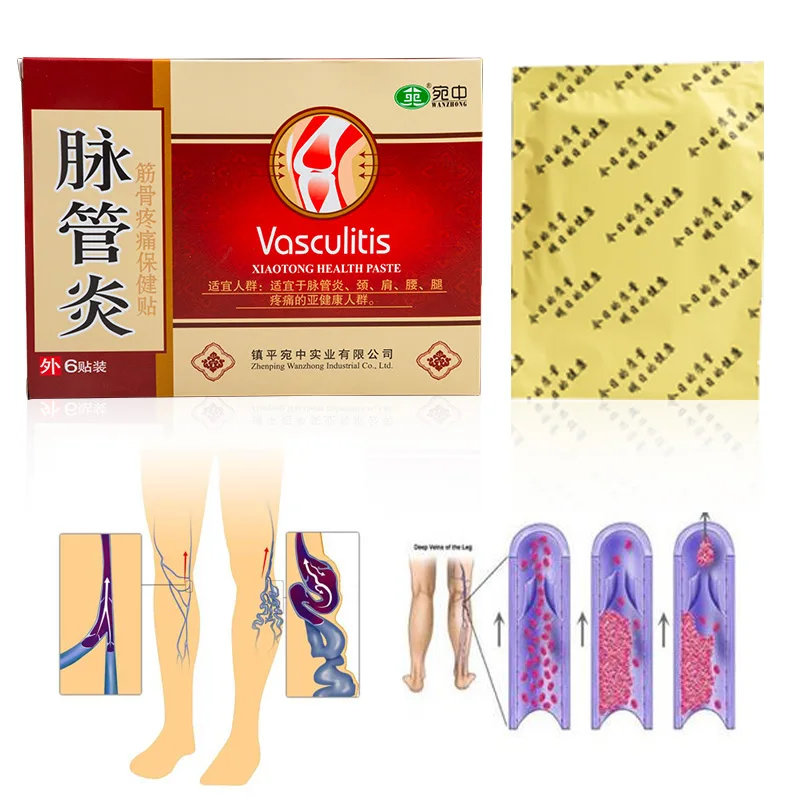 12 шт. = 2 коробки пластырь от варикозного расширения вен|Пластыри терапевтические|