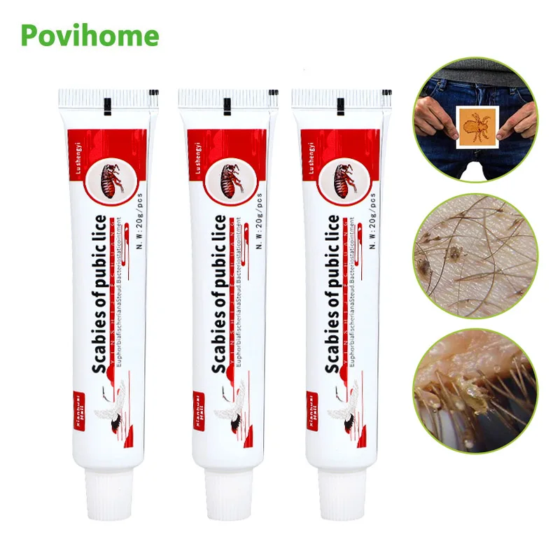 

3Pcs Anti-itching Ointment Head Lice Mites Removal Treatment Scabies Antibacterial Cream Herbal Medical Plaster Body Skin Care