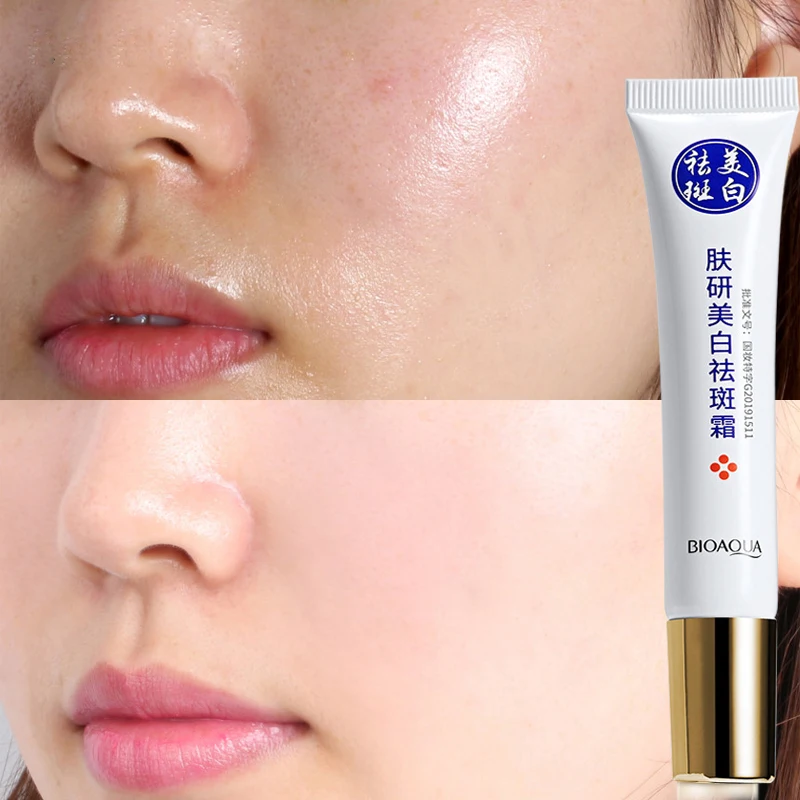 Отбеливающий крем для лица KO Strong Антивозрастная увлажняющая эссенция мелазмы