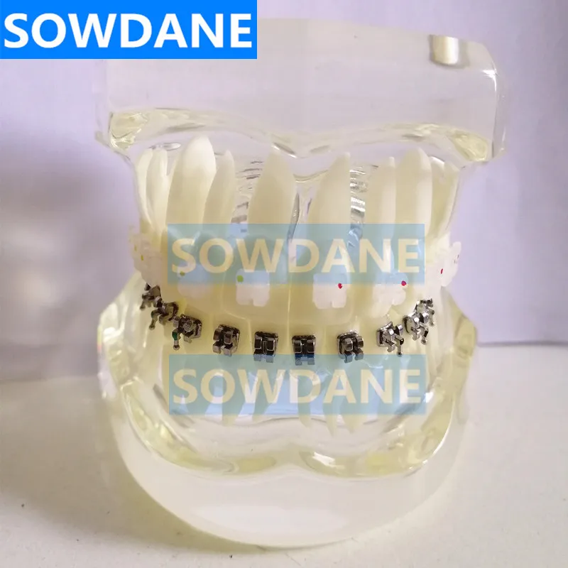 White 2 comparison Прозрачная Стоматологическая Ортодонтическая модель зубов с керамическими и металлическими кронштейнами для связи пациента - Цвет: White 2 comparison