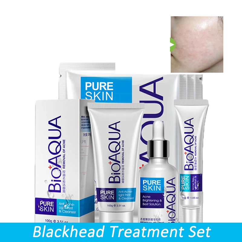 

4 шт., увлажняющий гель для удаления чёрных точек и шрамов