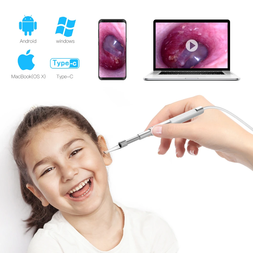 

Эндоскоп Otoscopio, 4,3 мм, многофункциональный, USB Type-c, 1,0 МП, HD, камера для чистки ушей, 6 светодиодов, отоскоп для ПК на базе Android