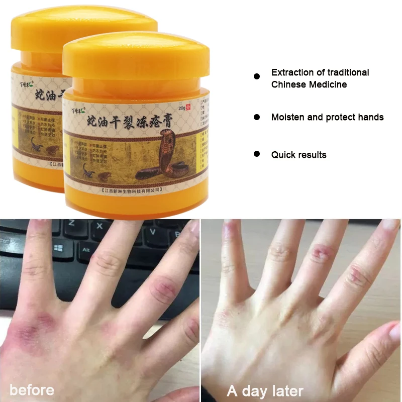 20G Winter Essential Snake Oil Anti-Chapping Dry Crack Treat Frostbite Hand Itching Redness Moisturizer Repair Skin Ointment | Красота и