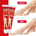 Крем для лечения варикозных вен, 20 г