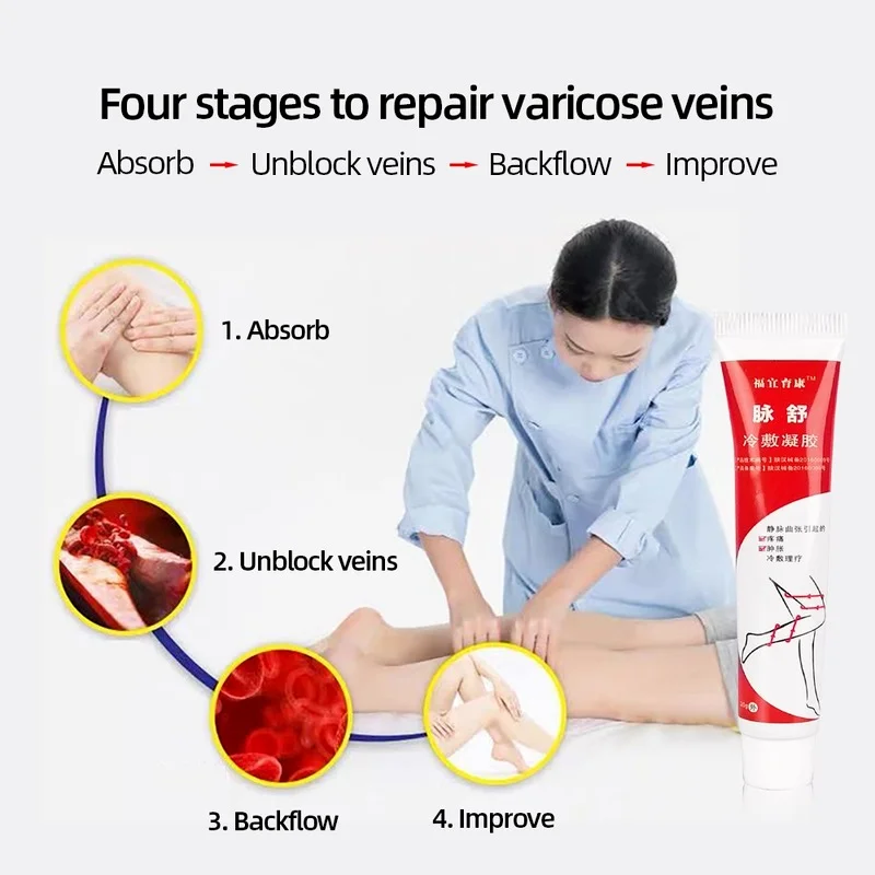

Varicose Vein Cold Compress Gel Phlebitis/Vasculitis Treatment Ointment Varicosity Angiitis Pain/Swelling Relief Body Care Cream