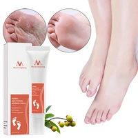 feet repair relieve beriberi treatment foot treatment products remove foot dryness anti fungal infection