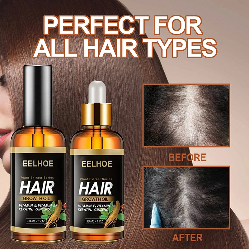 

New style 5 Minoxidil 5 Herbal Essential Argan Oil Hair Growth Serum Anti Loss Hair Oil N3 N6 Repairs And Strengthens All Hair