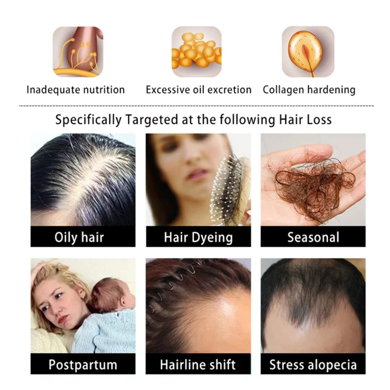 

Ginger hair refreshing and supple nourishing oil control moisturizing nourishing nourishing shampoo 200g