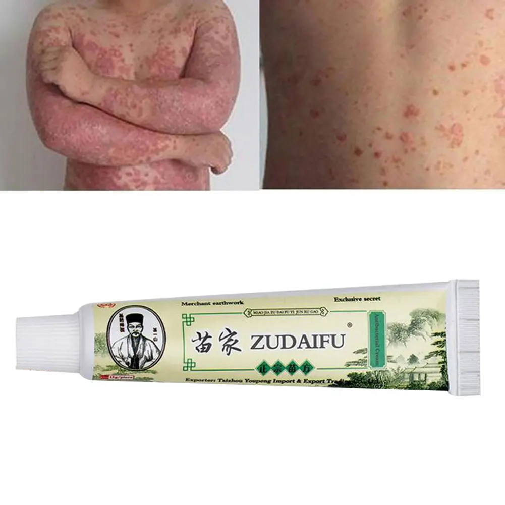

NERJING Zudaifu Psoriasis Cream Skin Care Cream Psoriasis Skin Cream Dermatitis Eczematoid Eczema Ointment Treatment 15g #E