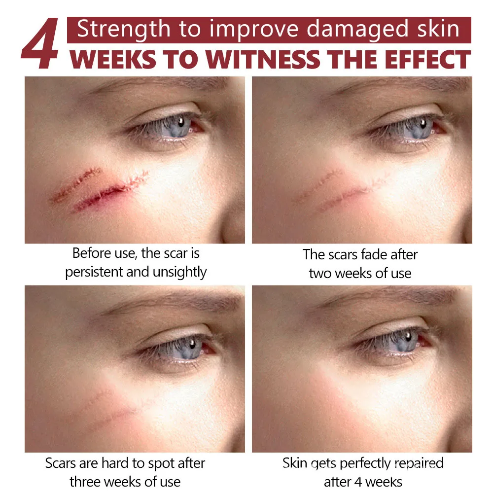 Centella Asiatica Anti-inflammatory Repairing Liquid Helps Decompose Melanin Promote Collagen Regeneration Fade Scars Face Serum |