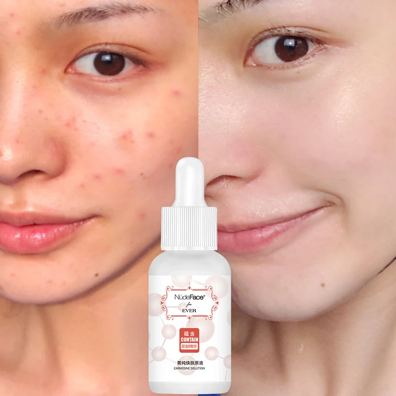 30ml Hyaluronic Acid Face Serum korean makeup Anti-Aging Shrink Pores Whitening Moisturizing Essence Cream Dry Skin Care | Красота и