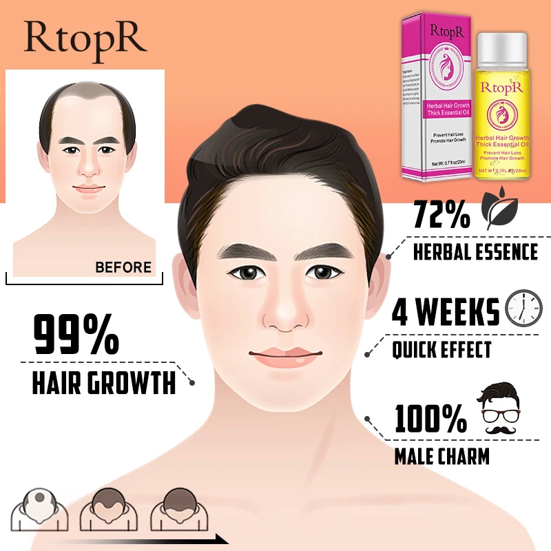 20 мл эфирное масло растительный рост волос от выпадения жидкость способствует